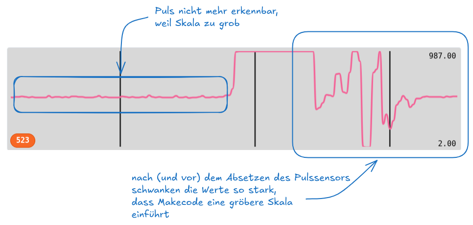 Der Puls lässt sich nur erkennen, wenn die Skala von Makecode sehr fein gewählt wurde. Dazu muss der Pulssensor eine Weile korrekt aufliegen, damit keine Ausreißer mehr vorhanden sind. pulssensor-skala-serieller-monitor